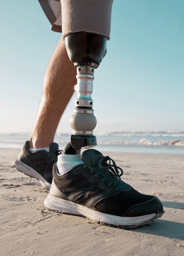 Konfor Ortopedi Bacak Protezi